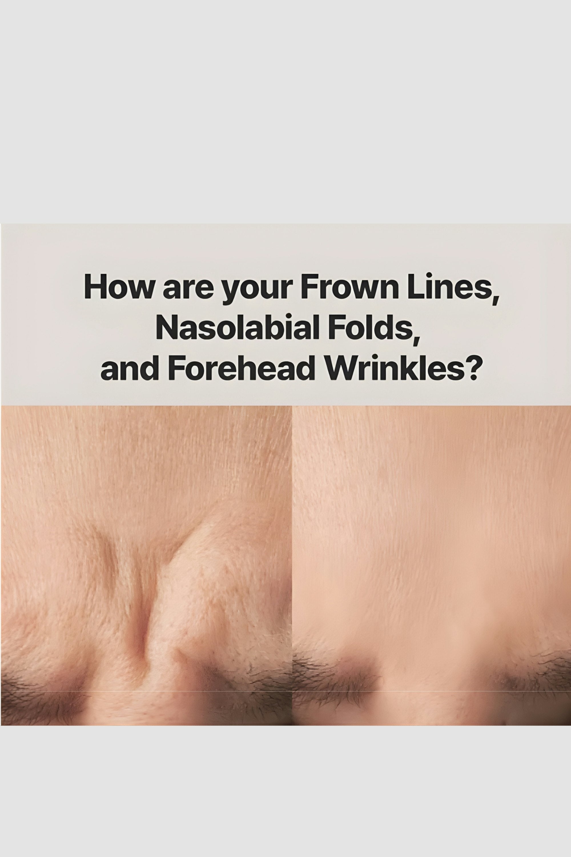 Wrinkle Repair Frown Line Patch