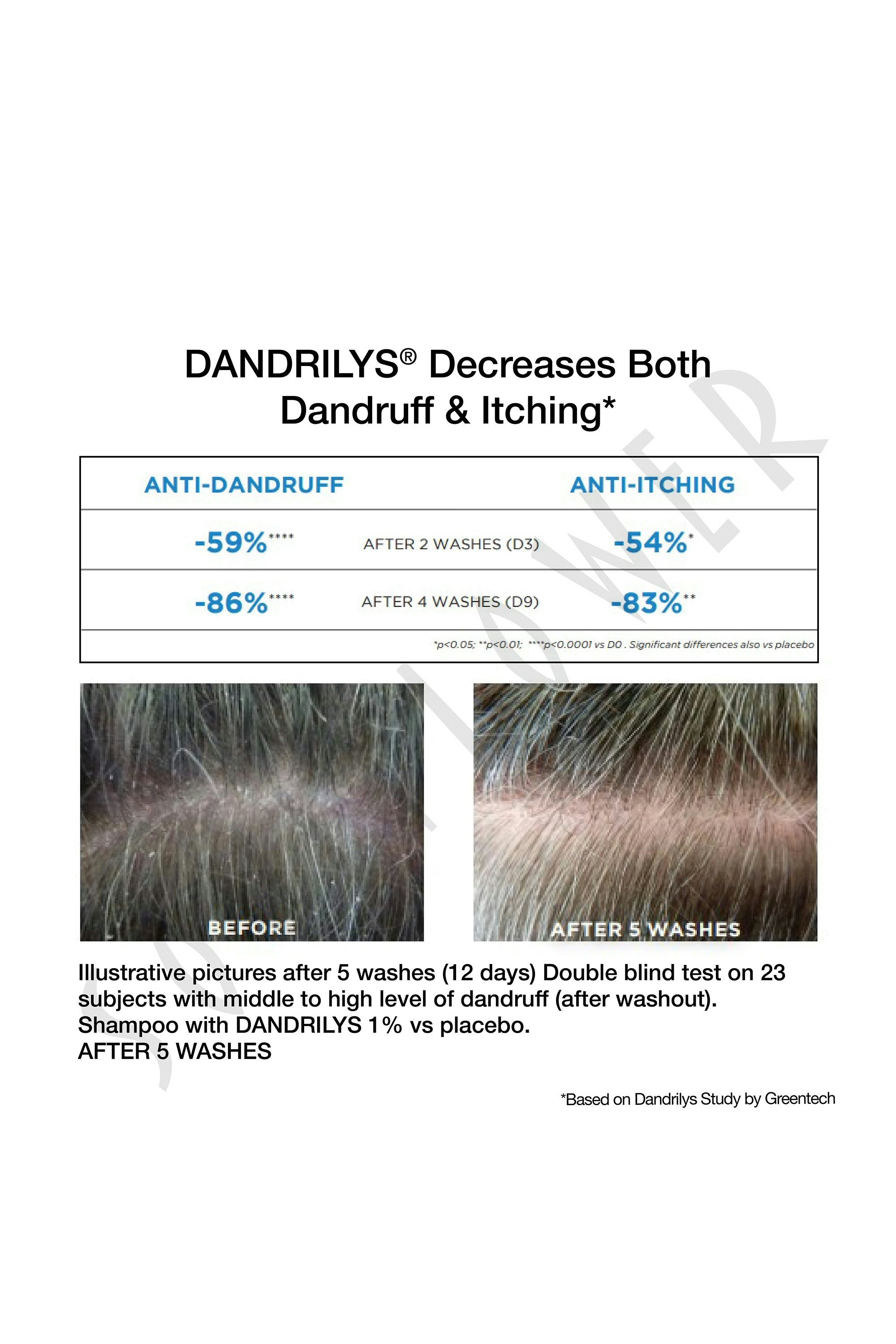 Anti Dandruff Shampoo