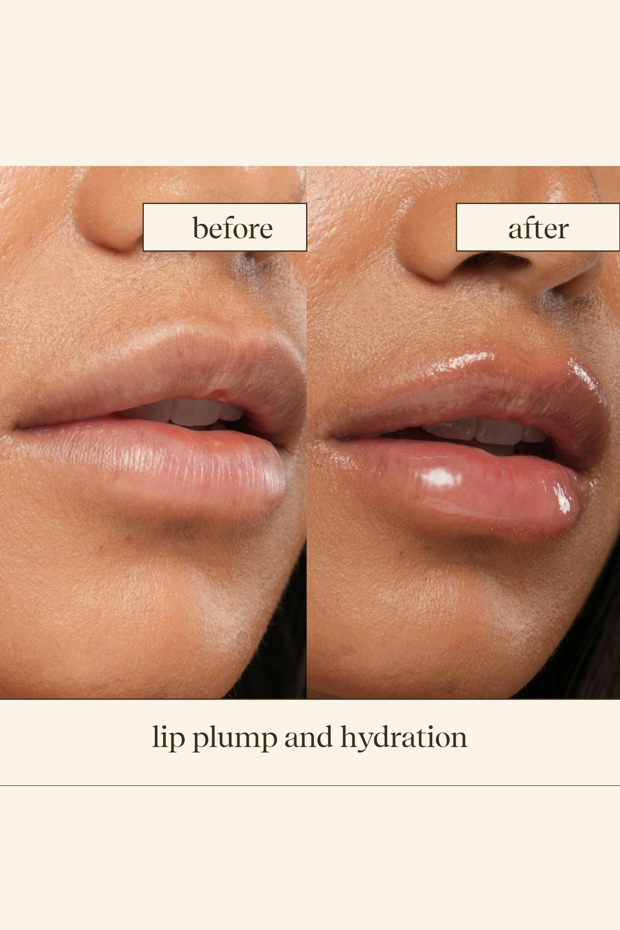 Dewy Lip Treatment